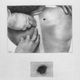 Illustration for article titled Reason for Conspiracy? 5 Mysterious Details From JFKs Autopsy